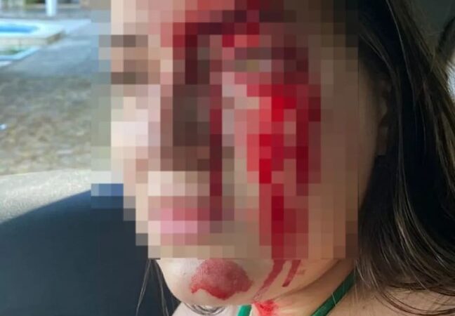 Vítima denuncia namorado e chora ao falar da dificuldade para perceber violência: ‘eu não conseguia ver como agressor