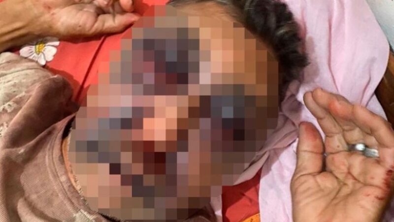 Agressão brutal deixa homem gravemente ferido em Milton Brandão