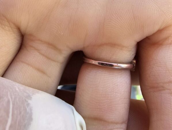 Bombeiro Civil é acionado para retirar anel preso em dedo de adolescente em Piripiri