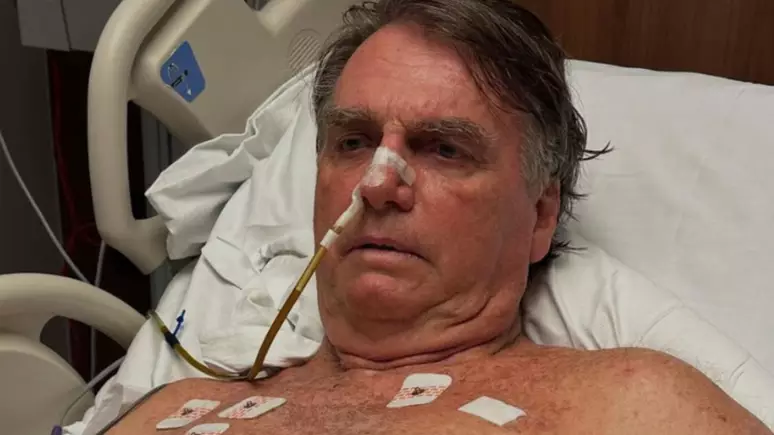 Bolsonaro passará a noite no hospital após crise de soluço e vômitos