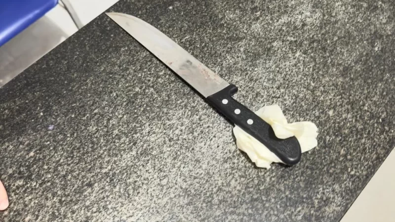 Sobrinho mata tio a facadas durante briga em Pedro II; vítima teve vísceras expostas