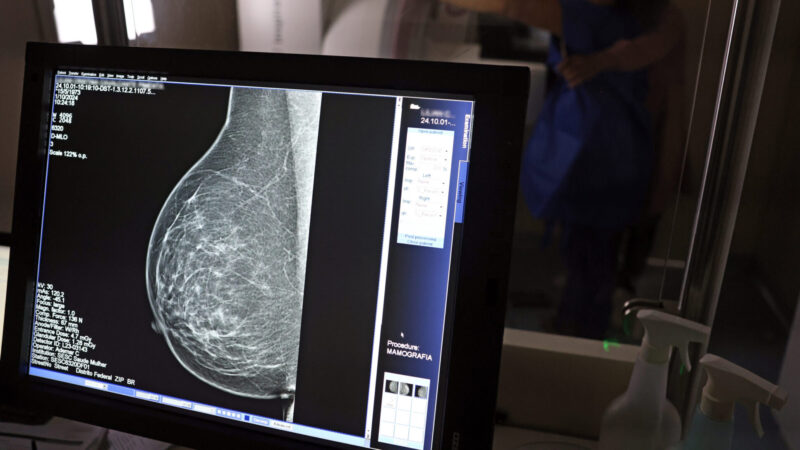 Outubro Rosa: Piauí realiza 57 mil mamografias e recebe 224 medicamentos para câncer de mama